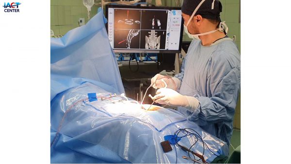 Spine surgeries
